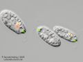gal chilomonas paramecium