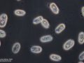 gal chilomonas paramecium