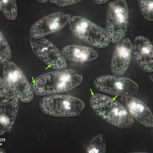 gal chilomonas paramecium staerkekoerner1 gal chilomonas paramecium staerkekoerner1
