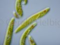 euglena spirogyra