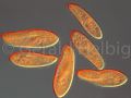 paramecium caudatum