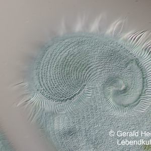 gal stentor coeruleus