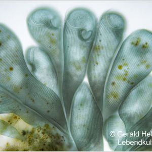 gal stentor coeruleus