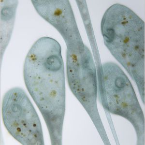 gal stentor coeruleus