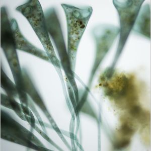 gal stentor coeruleus